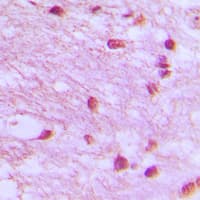Polyclonal Rabbit anti-Human LIG4 / DNA Ligase IV Antibody (Internal, IHC, IF, WB)
