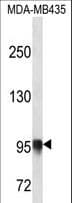 Polyclonal Rabbit anti-Human PLOD3 Antibody (aa78-105, WB)