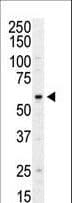 Polyclonal Rabbit anti-Human PI4K2A / PI4KII Antibody (aa1-30, IHC, IF, WB)