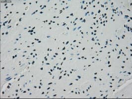 Monoclonal Mouse anti-Human CRYAB / Alpha B Crystallin Antibody (clone OTI2A1, IHC, IF, WB)