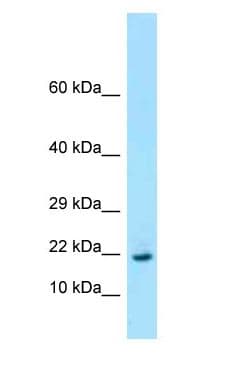 Polyclonal Rabbit anti-Mouse RPL26 / Ribosomal Protein L26 Antibody (aa64-113, WB)