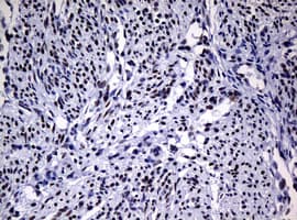 NBN / Nibrin Antibody (clone OTI2E10)