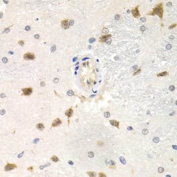 CDC25A Antibody