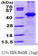 Human ACY1 / Aminoacylase 1 Protein (Recombinant His)
