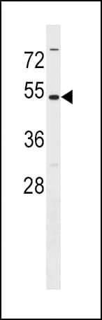 IHC-plus™ MAT2A Antibody (aa27-55)