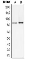 PIK3R2 / p85 Beta Antibody (Internal)