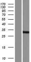 Human RNASEH2B Protein (Over-Expression Lysate Myc-DDK (Flag))