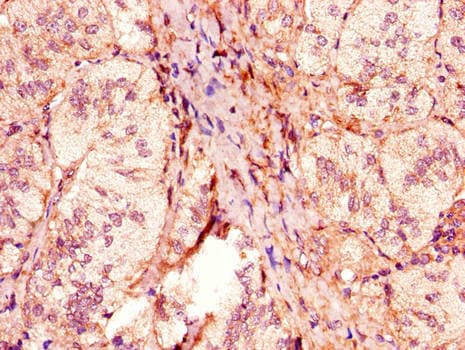 Polyclonal Rabbit anti-Human ACOX1 / ACOX Antibody (IHC, IF)