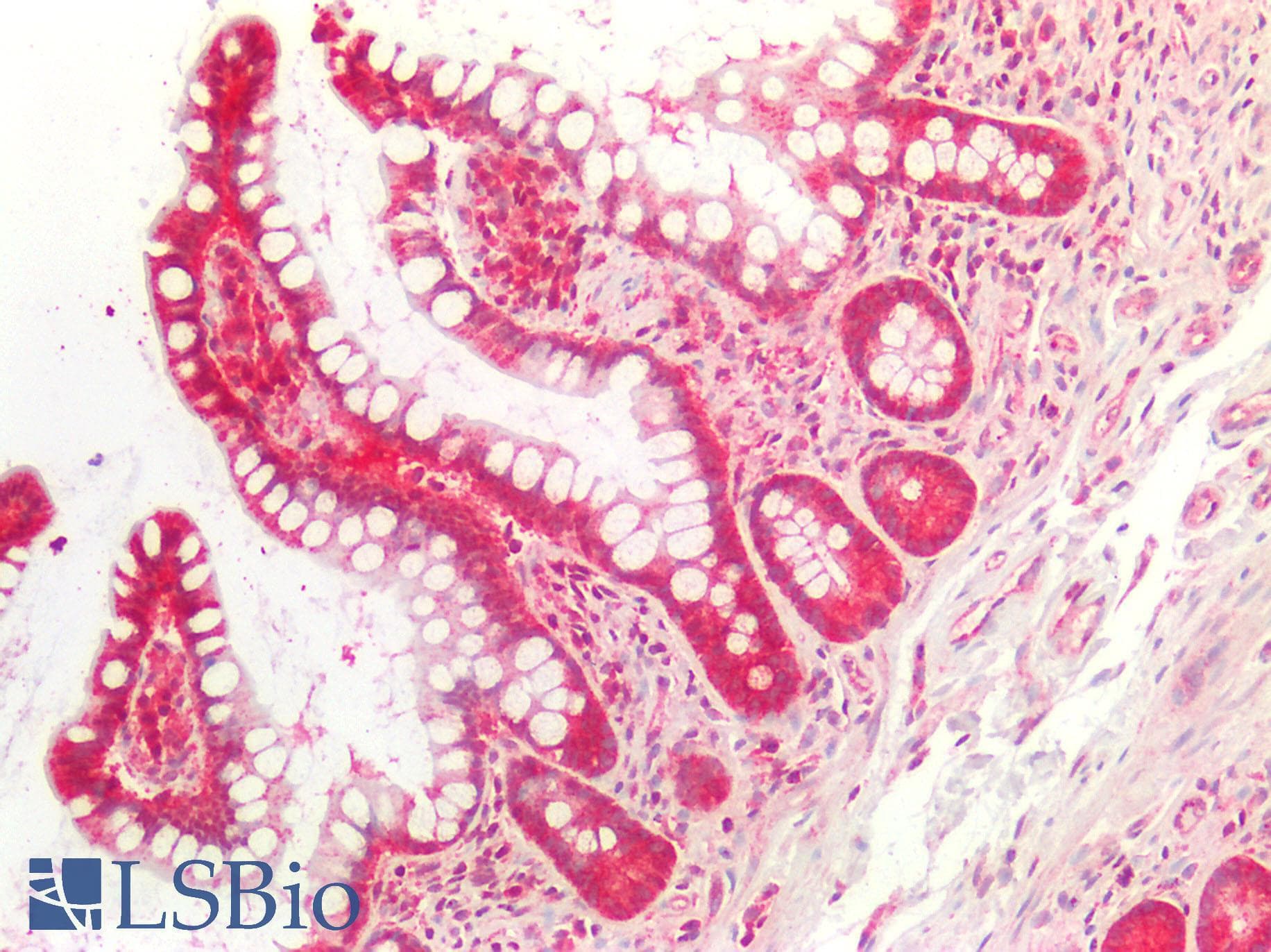 IHC-plus™ EXT1 Antibody