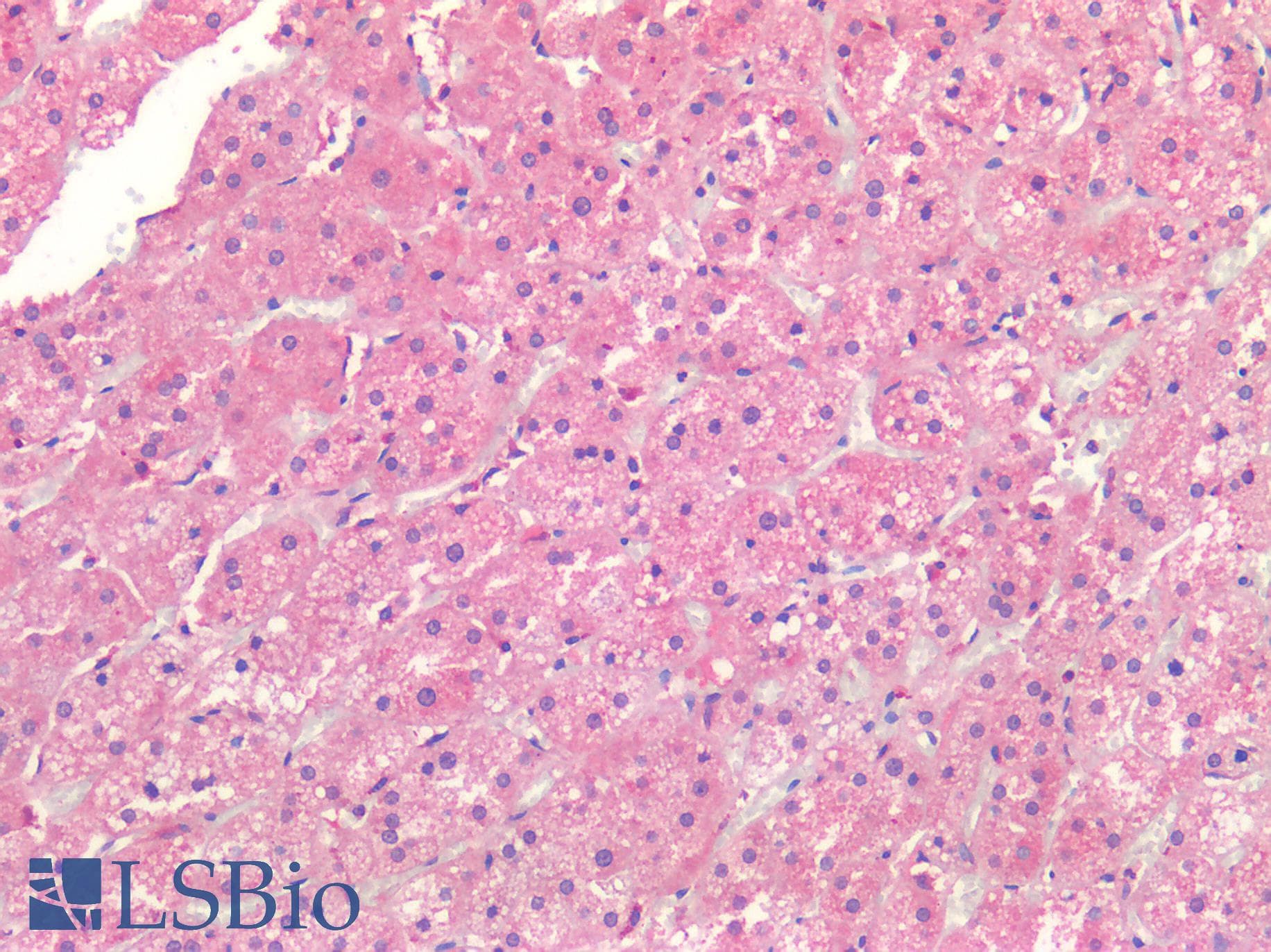 IHC-plus™ ALK2 / ACVR1 Antibody