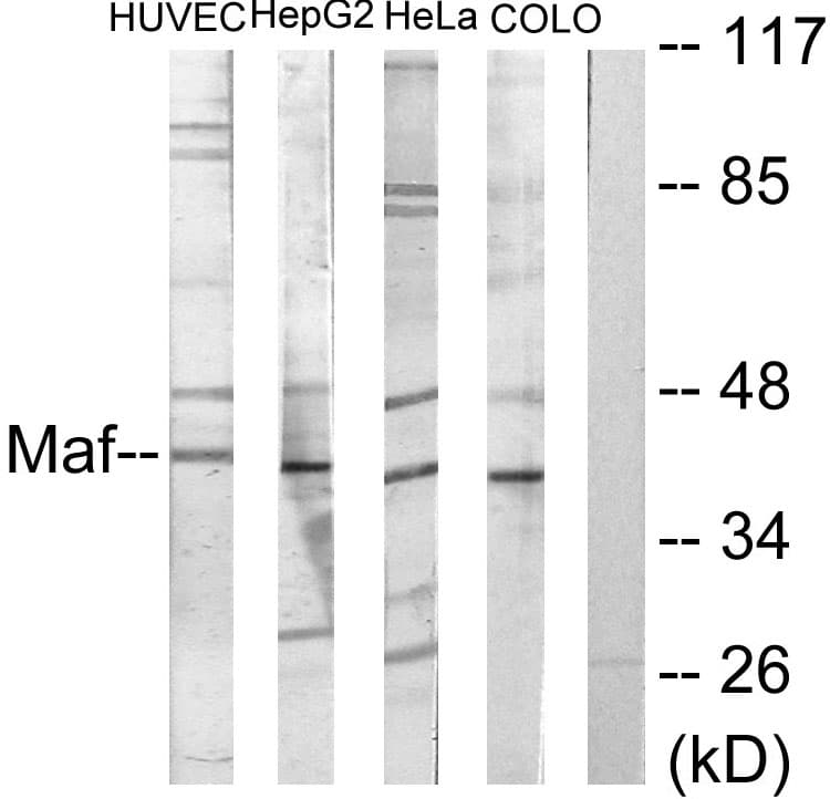 IHC-plus™ Polyclonal Rabbit anti-Human c-Maf Antibody (aa301-350, IHC, WB)