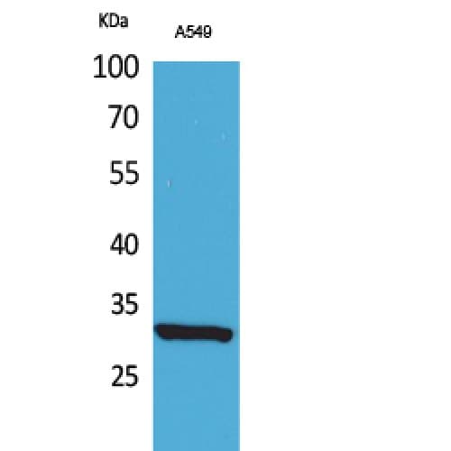 Polyclonal Rabbit anti-Human ATF5 Antibody (acetylation site of K29., WB)