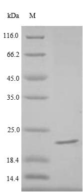Delta-theraphotoxin-Hm1a (Heteroscodra maculata) Protein (Recombinant 6His-SUMO, N-terminus + Myc, C-terminus)