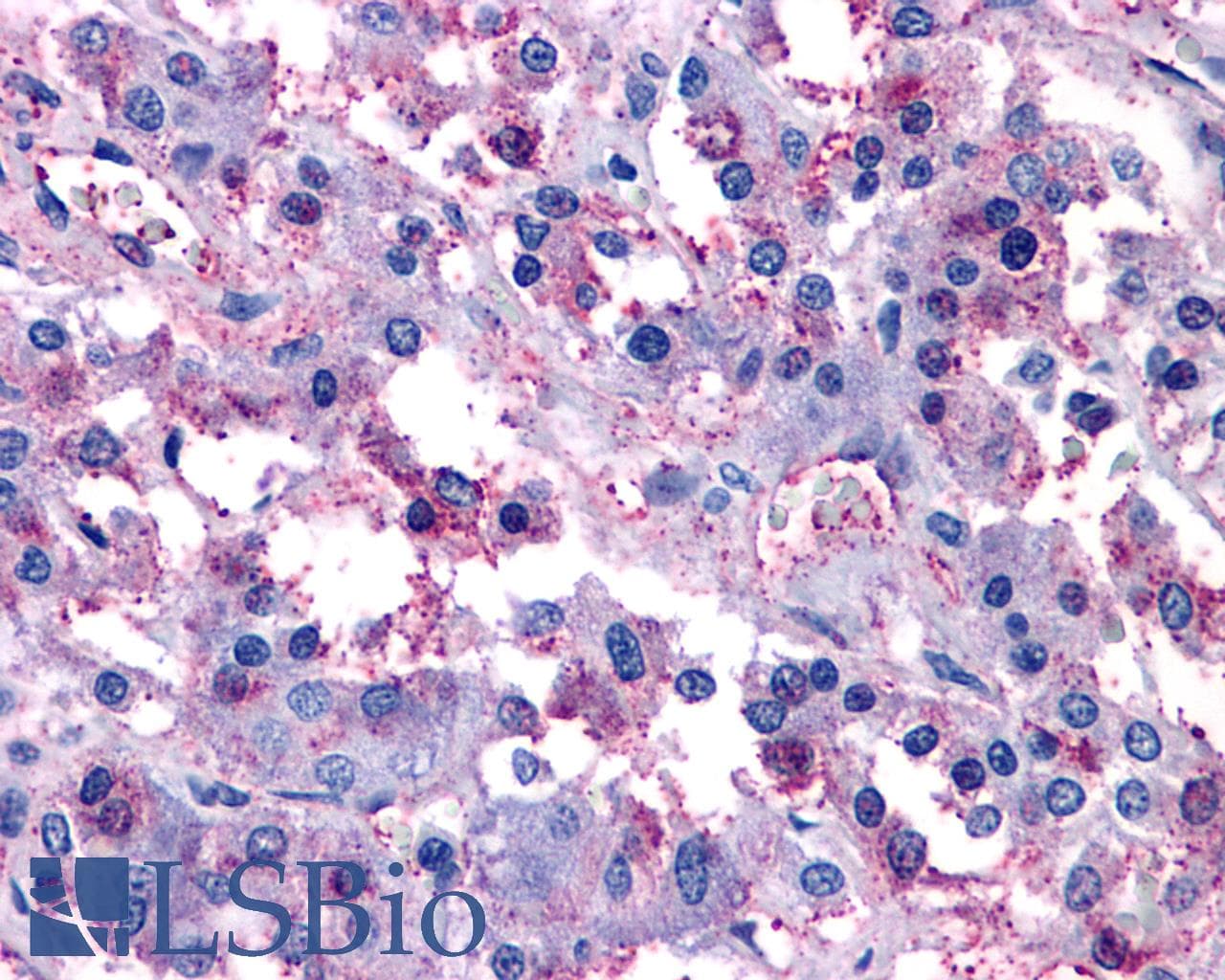 IHC-plus™ VIPR1 Antibody (Cytoplasmic Domain)