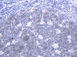 Monoclonal Mouse anti-Human MUC16 / CA125 Antibody (clone OTI2H4, Carrier-free, aa10329-10628, WB)