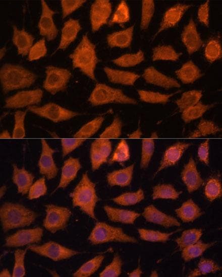 LGMN / Legumain Antibody