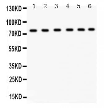ECaC / TRPV5 Antibody (aa580-610)