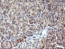 PIK3R5 Antibody (clone OTI6C5)