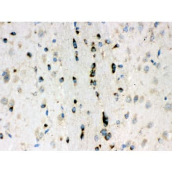 Lumican Antibody (aa68-338)