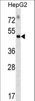 RAPGEF5 / GFR Antibody (aa529-555)