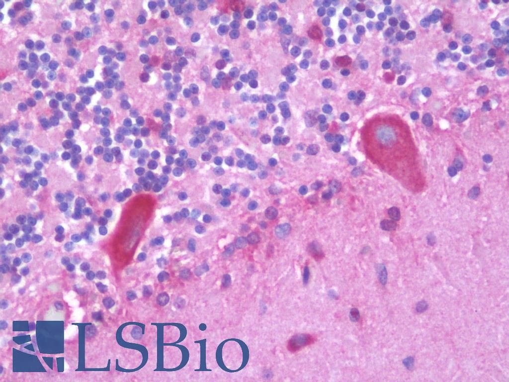 IHC-plus™ CHRNA10 Antibody (aa394-443)