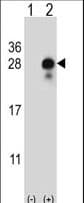 DLK2 Antibody (aa353-380)
