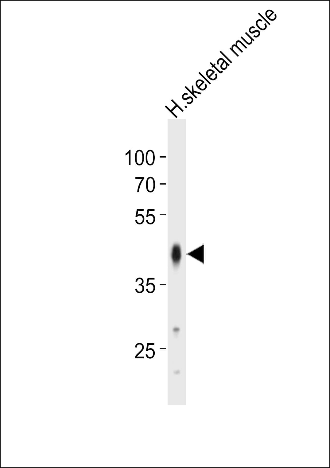 Polyclonal Rabbit anti-Human POU5F1B Antibody (aa102-135, WB)