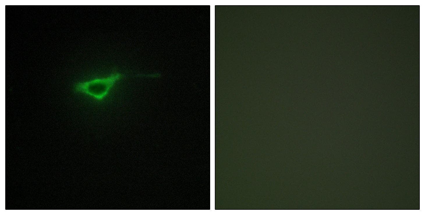 Polyclonal Rabbit anti-Human COL20A1 / Collagen XX Antibody (IHC, IF, WB)