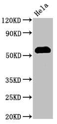 Polyclonal Rabbit anti-Human HSF1 Antibody (IHC, IF, WB)
