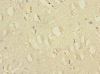 CACNG7 Antibody