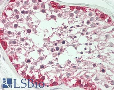 IHC-plus™ OXSR1 / OSR1 Antibody (aa375-425)