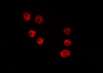 HELZ2 / PRIC285 Antibody