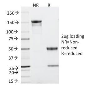 TP53 / p53 Antibody (clone TRP/816, Azide-free, BSA-free)