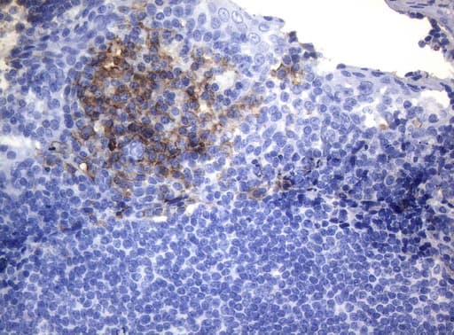 Monoclonal Mouse anti-Human CD38 Antibody (clone OTI1C9, aa43-300, IHC, WB)