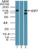 Polyclonal Rabbit anti-Human IPO7 / RANBP7 Antibody (aa1-50, IHC, WB)