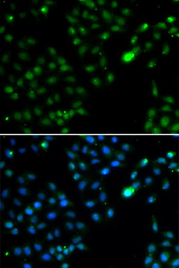 FKBP25 / FKBP3 Antibody