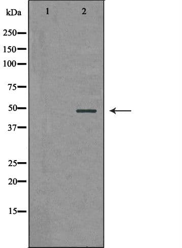 Polyclonal Rabbit anti-Human PSMC5 / SUG1 Antibody (IHC, WB)