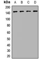 BRIP1 / BACH1 Antibody