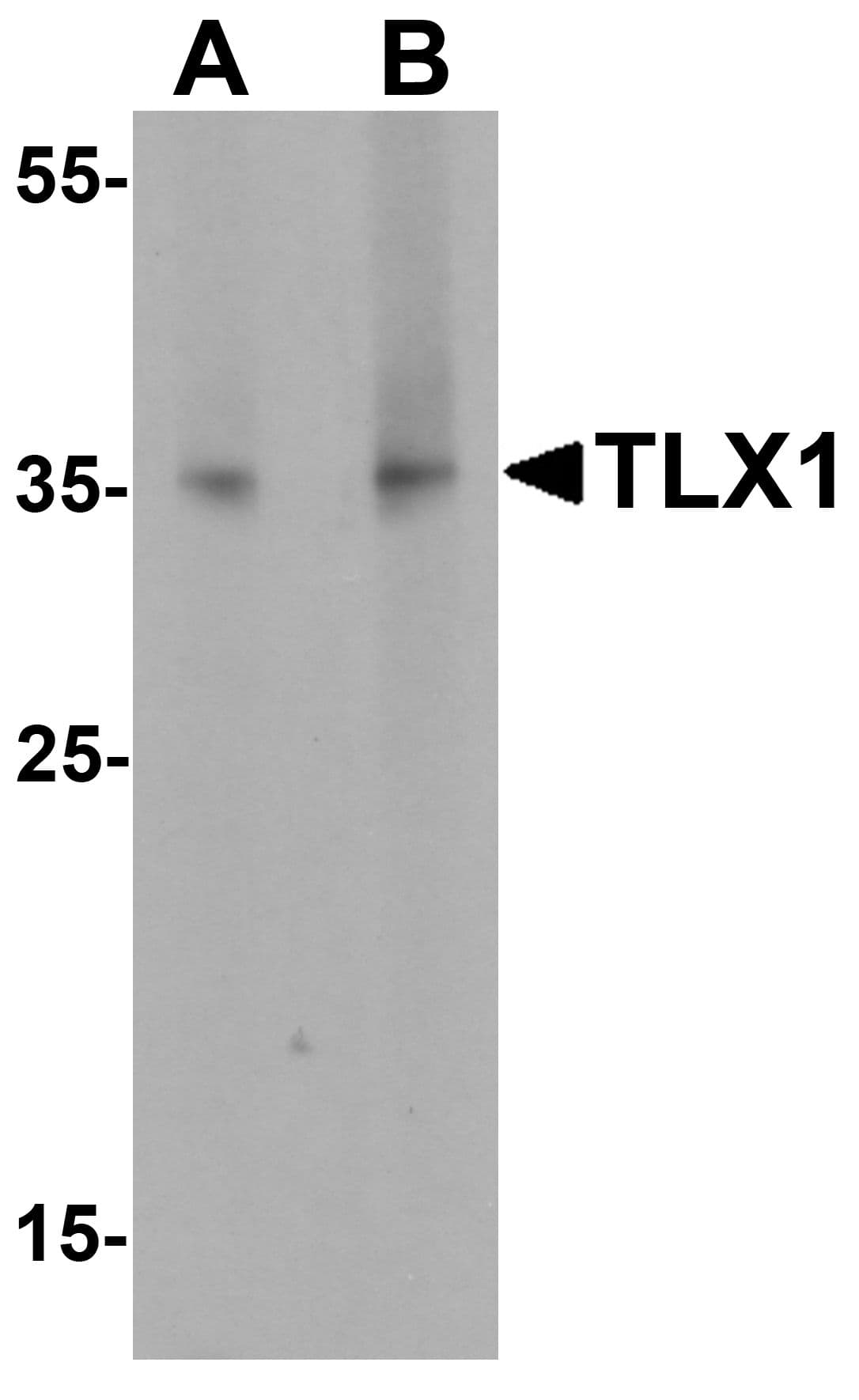 IHC-plus™ TLX1 / HOX11 Antibody