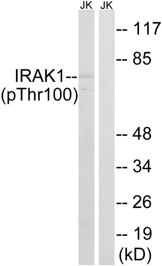 IRAK1 / IRAK Antibody (phospho-Thr100)