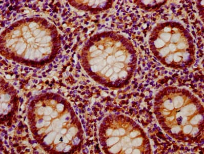 PTPN9 / MEG2 Antibody