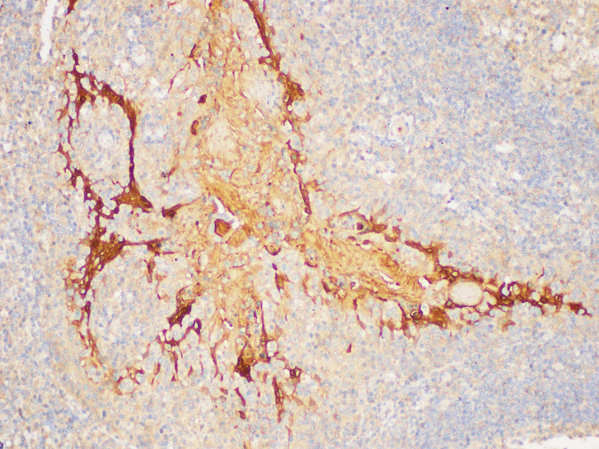 SERPINB2 / PAI-2 Antibody