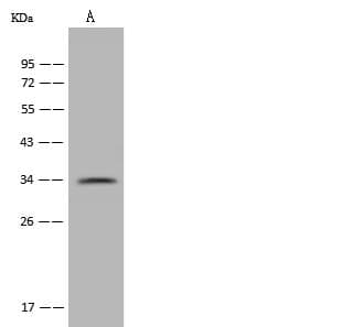 PARP16 Antibody