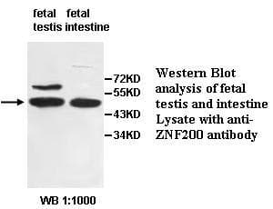 ZNF200 Antibody (aa142-393)