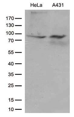 JUP/CTNNG/Junction Plakoglobin Antibody (aa500-745, clone OTI4D5)