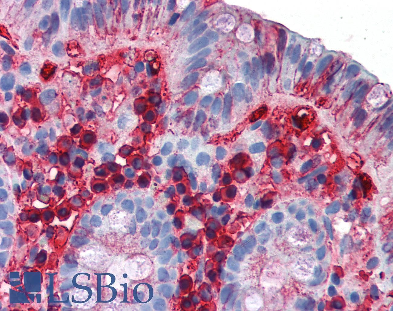 Mouse Anti-Human IgA Secondary Antibody (clone Mc24-2E11)