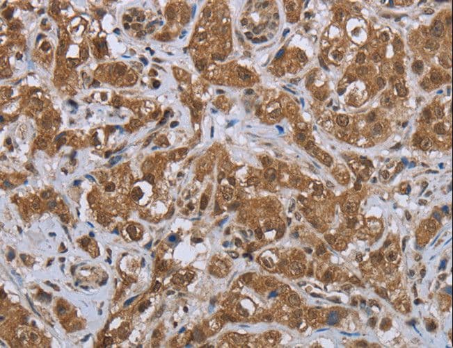 GABRB1 Antibody