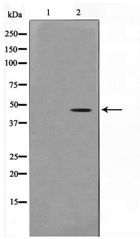 Polyclonal Rabbit anti-Human ACTG2 Antibody (IHC, WB)