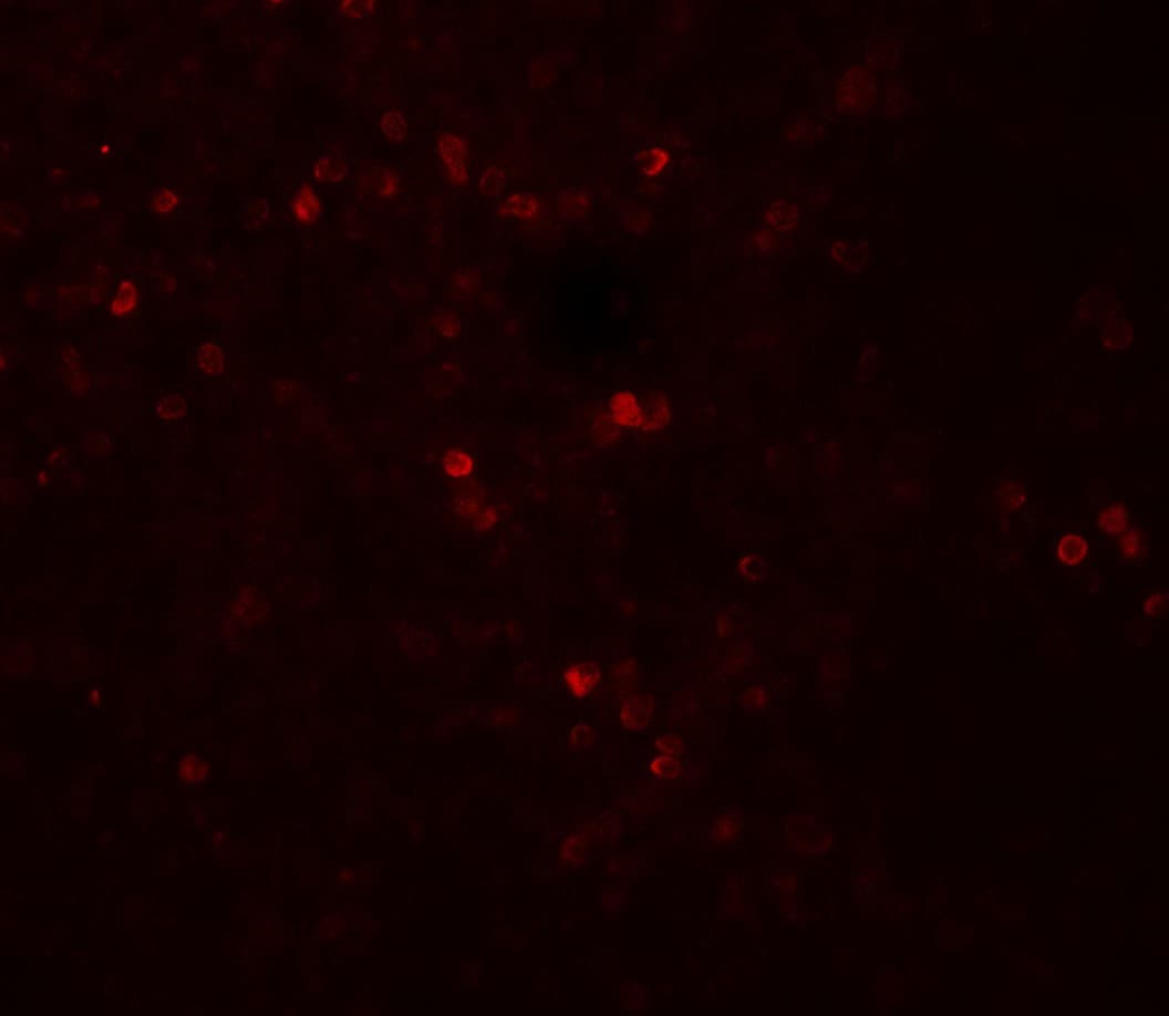 SNRPN Antibody