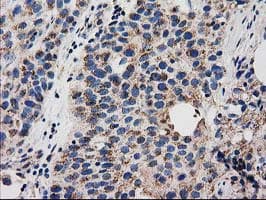 GRHPR / Glyoxylate Reductase Antibody (clone OTI1A9, Carrier-free)